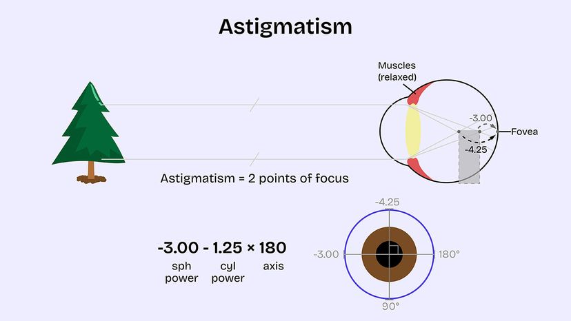 Can Eyeglasses Correct Astigmatism?