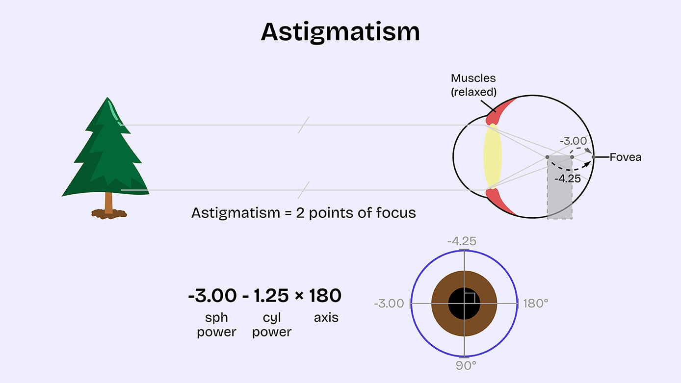 Can Eyeglasses Correct Astigmatism