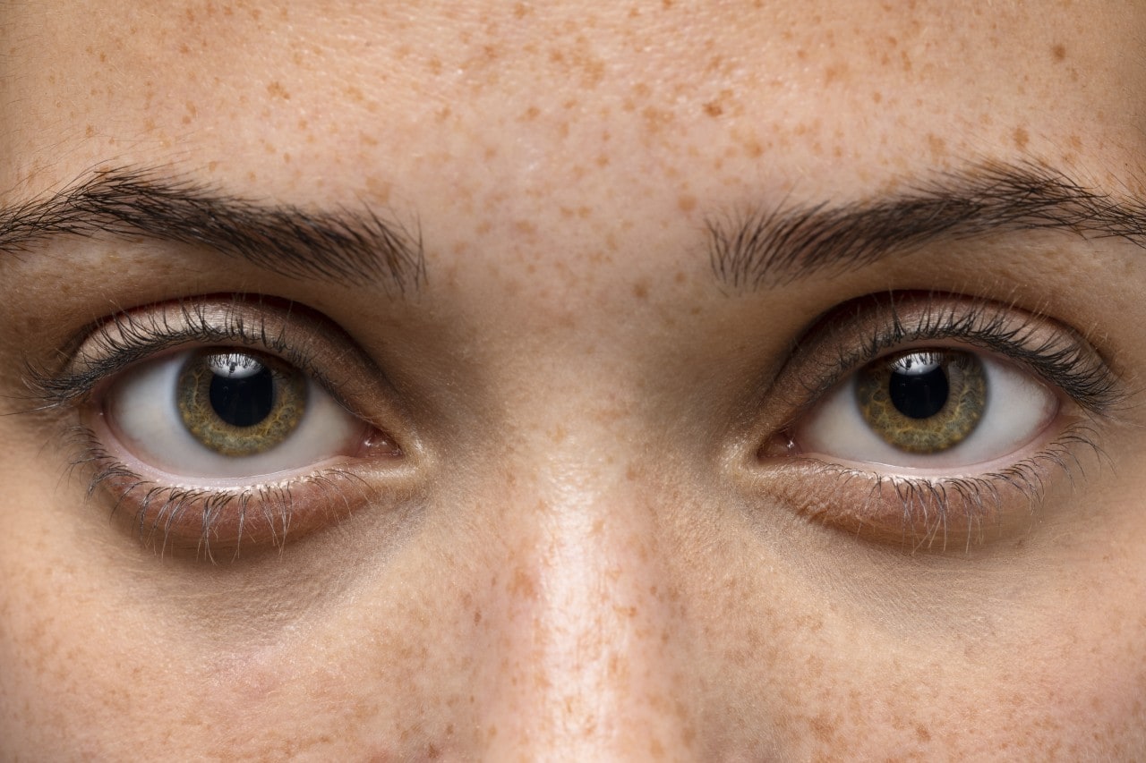 Close-up of a woman's natural green eyes and eyelids showing slight eye discharge accumulation near the tear ducts.