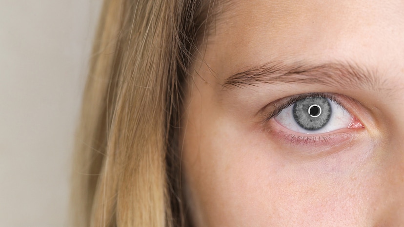What Causes Gray Eyes? The Science Behind This Rare Eye Color