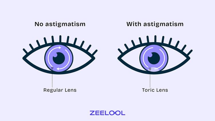What the Difference between Toric Lenses and Regular Lenses?