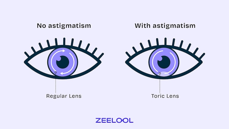 What the Difference between Toric Lenses and Regular Lenses?