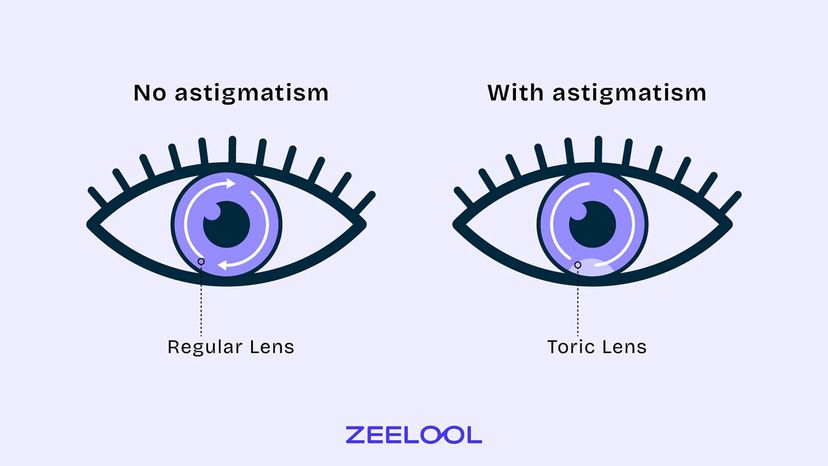 What the Difference between Toric Lenses and Regular Lenses?