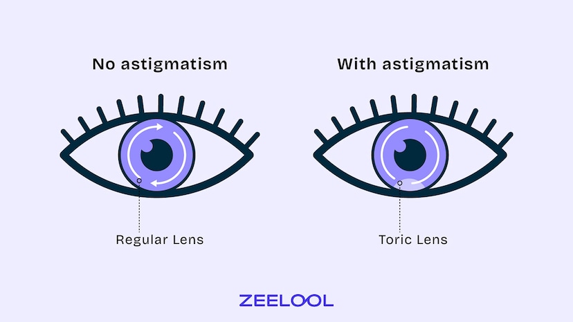 What the Difference between Toric Lenses and Regular Lenses?
