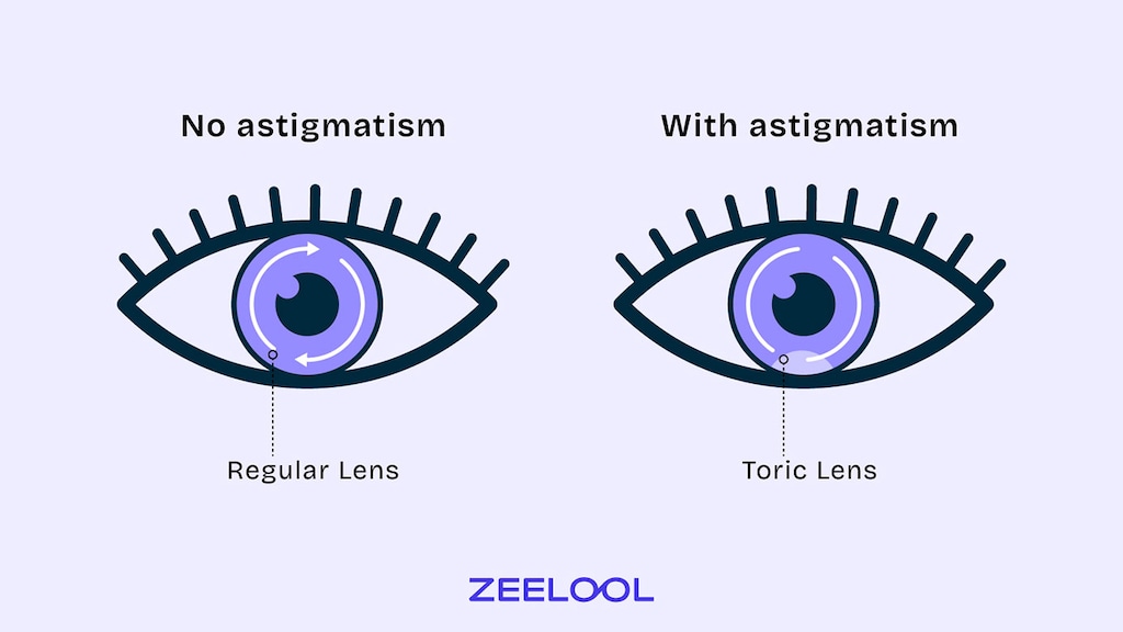 What the Difference between Toric Lenses and Regular Lenses?