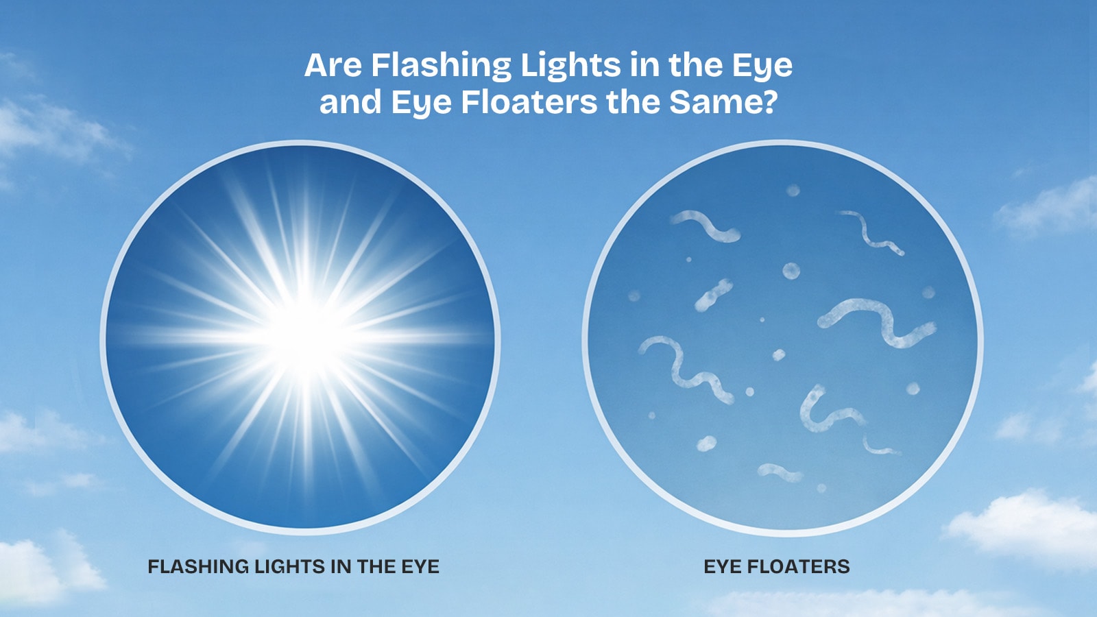 Illustration comparing flashing lights in the eye to eye floaters against a blue sky background.