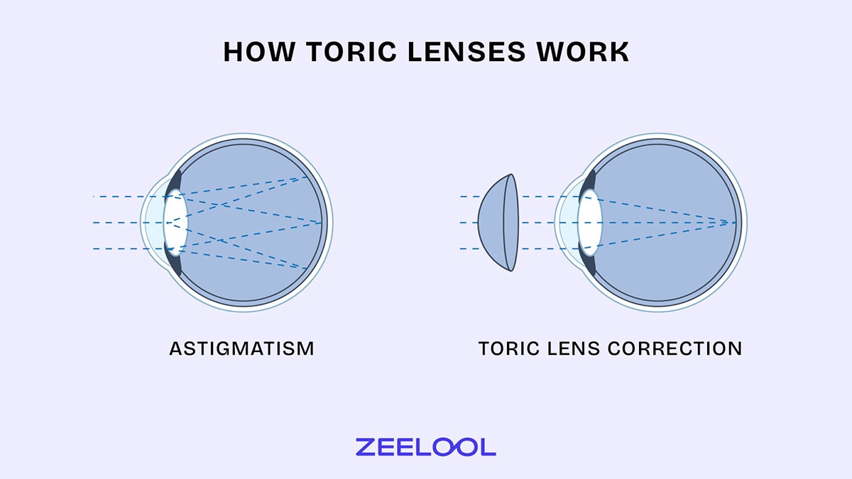 Toric Lenses